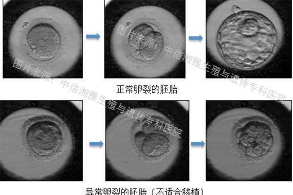 胚胎分裂异常
