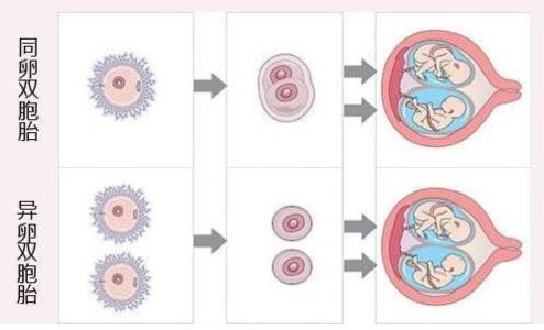 试管婴儿技术下双胞胎出生率究竟有多高？