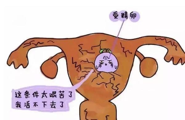 胚胎着床失败