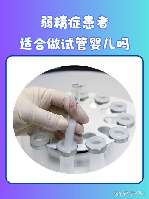 试管婴儿技术究竟算不算手术？深入解析与探讨