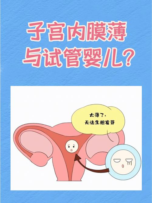 试管婴儿、内膜薄、生殖医疗