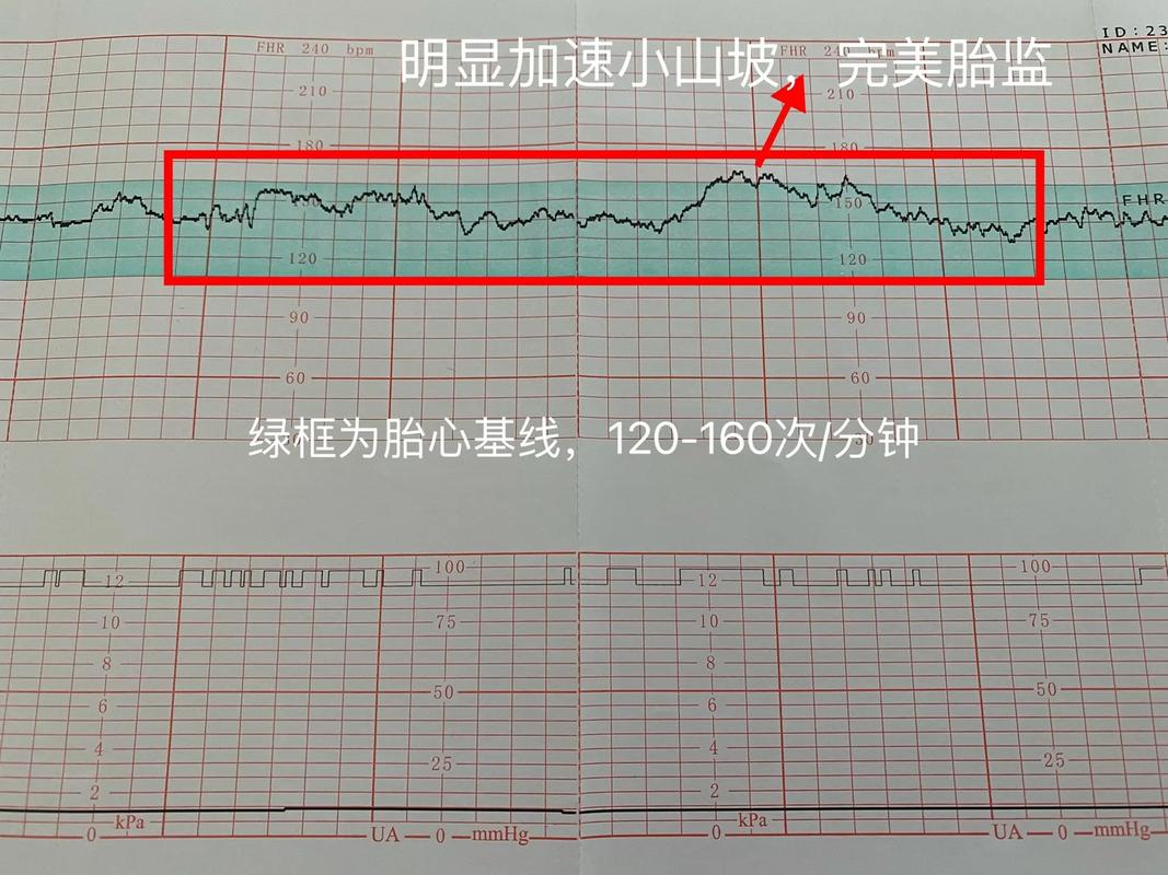 胎心跳确认时间