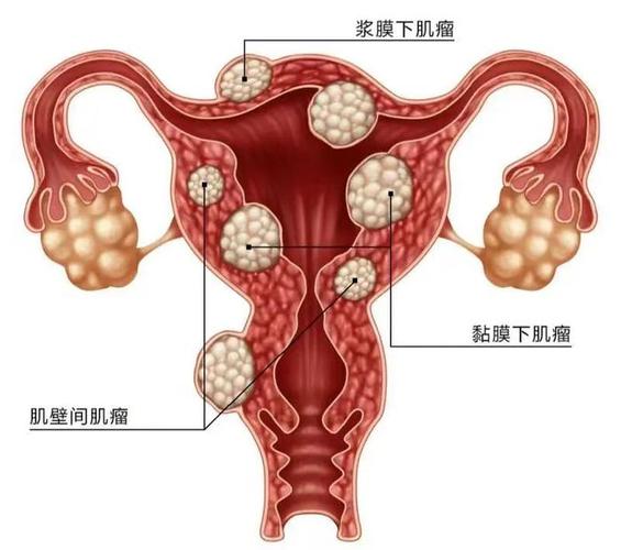 子宫内膜状况