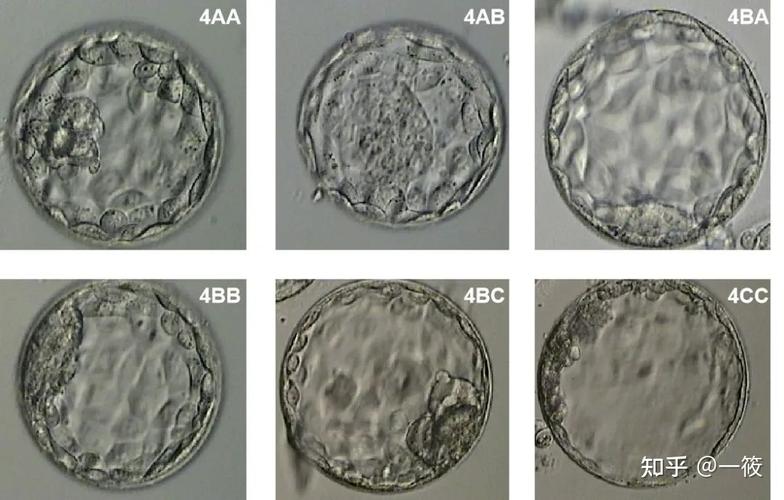 试管婴儿胚胎优劣判断