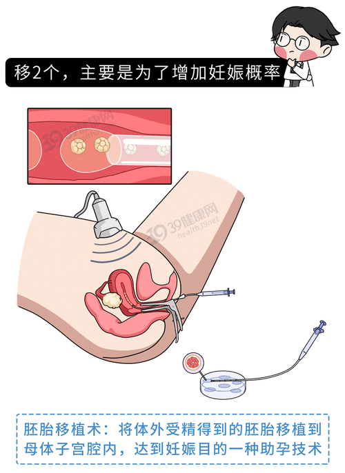 试管婴儿、复苏移植、生殖医疗