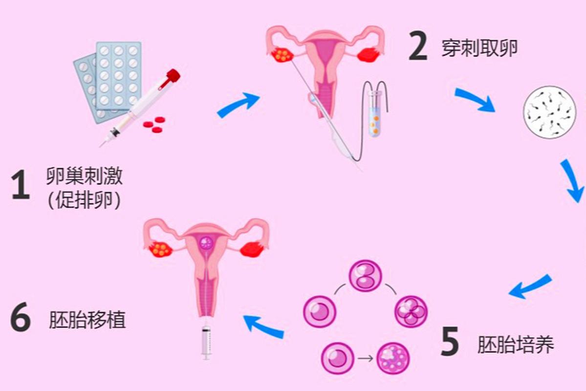 试管婴儿检查后如何进行有效的促排卵？