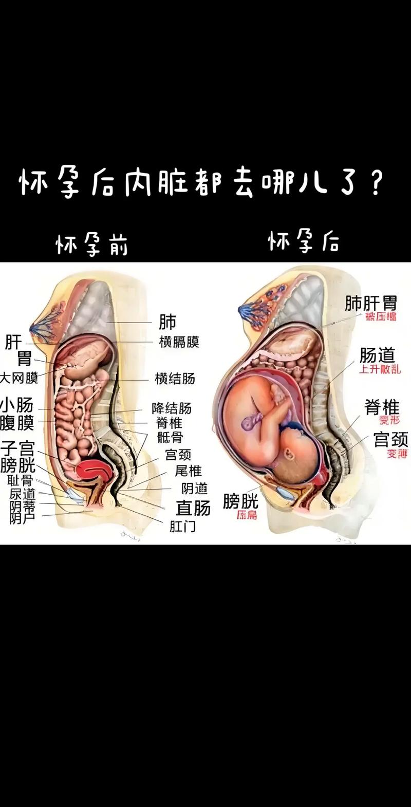 妊娠位置