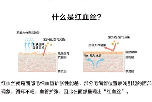 血丝原因