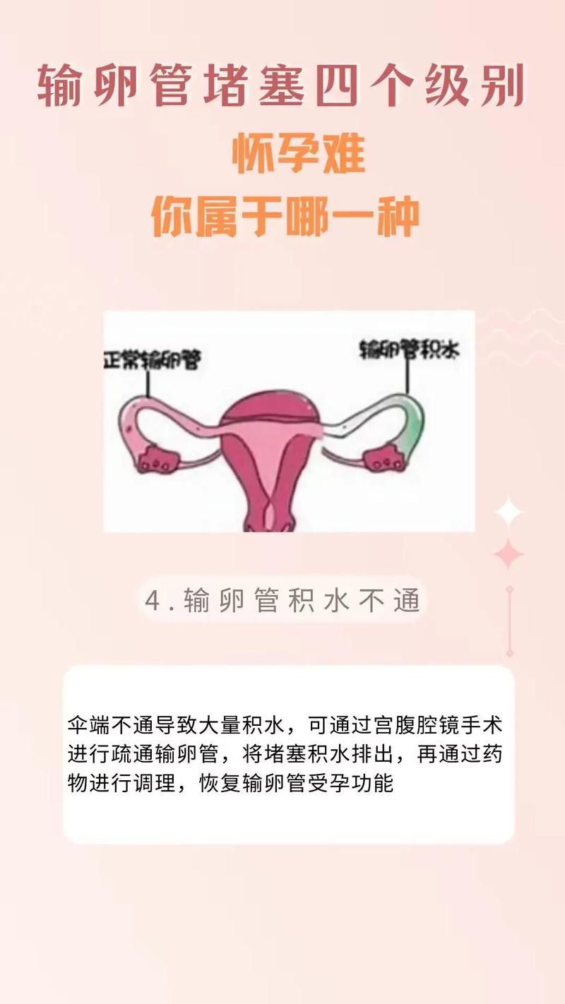  输卵管通畅性