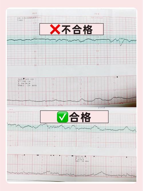 胎心慢