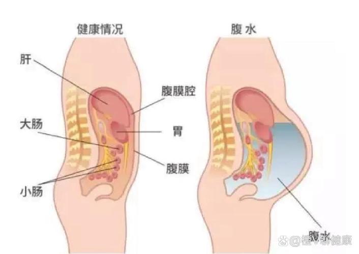 积水原因