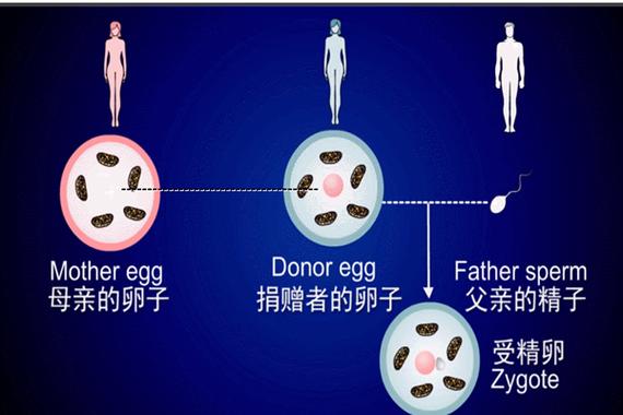  第四代试管婴儿