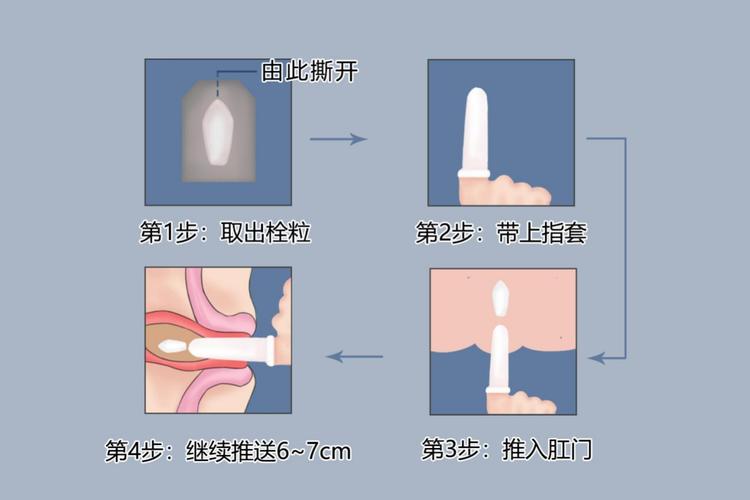 药物塞入治疗