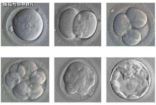 试管婴儿囊胚
