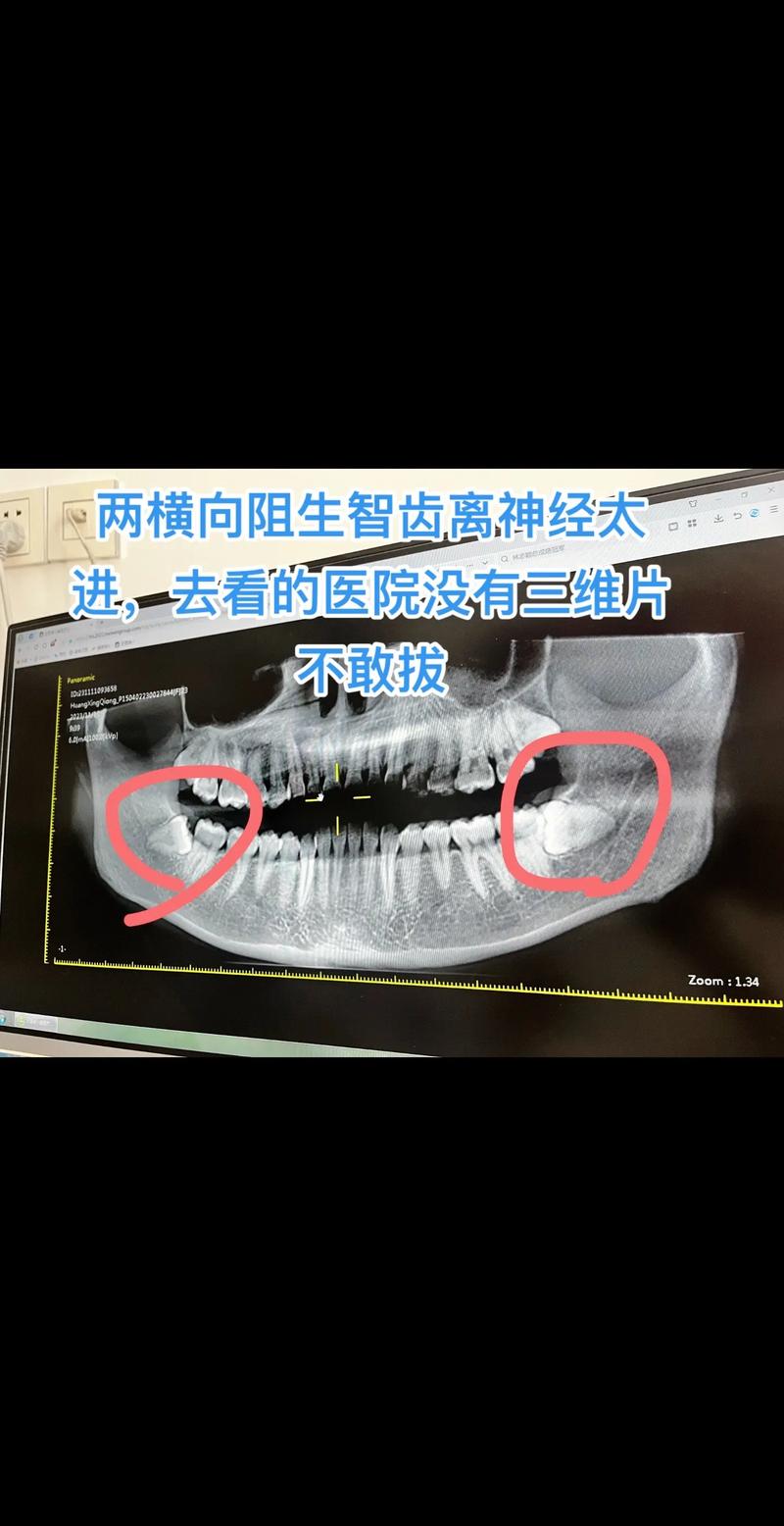  智齿再生