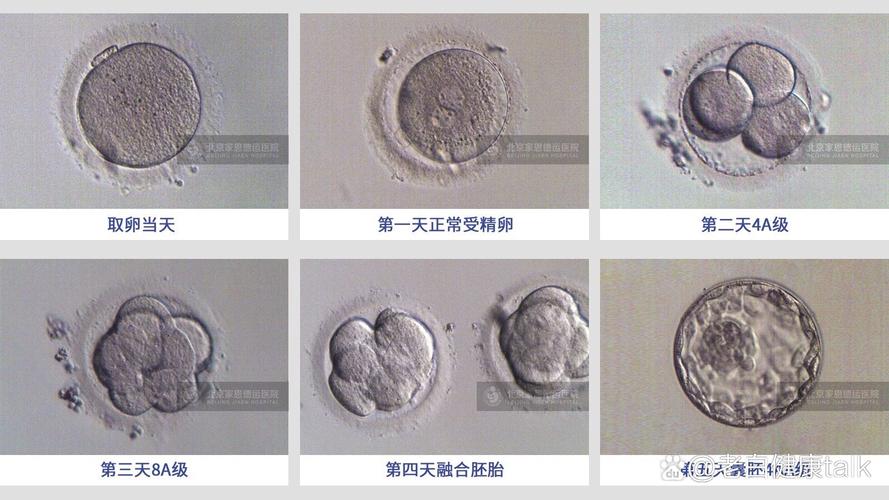 试管婴儿促排卵的最佳数量是多少个卵？