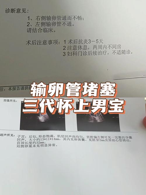 试管婴儿过程中如何检查输卵管功能与健康状态？