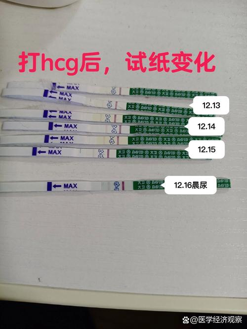 忘记打 hcg