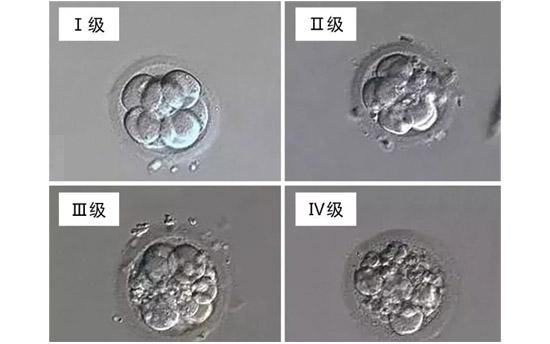 试管婴儿胚胎分级标准大全：优质胚胎具体是几级？