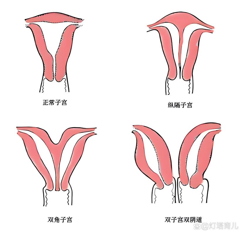  宫腔异常