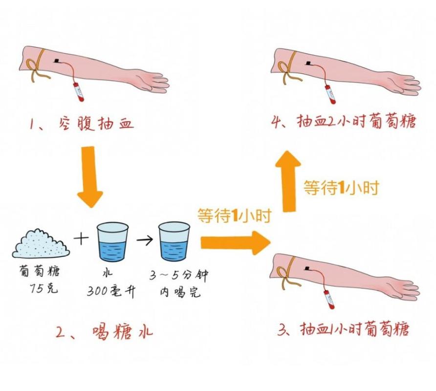 糖耐量检查