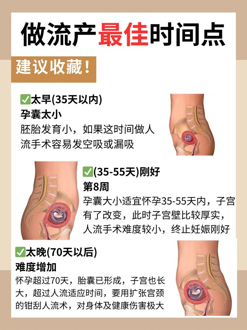 流产后怀孕时间