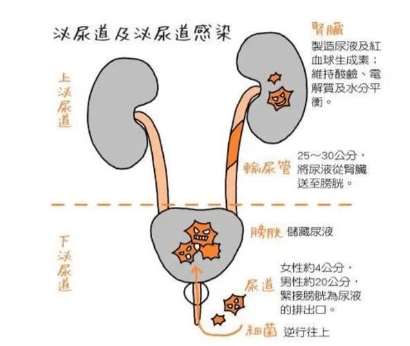 泌尿系统感染