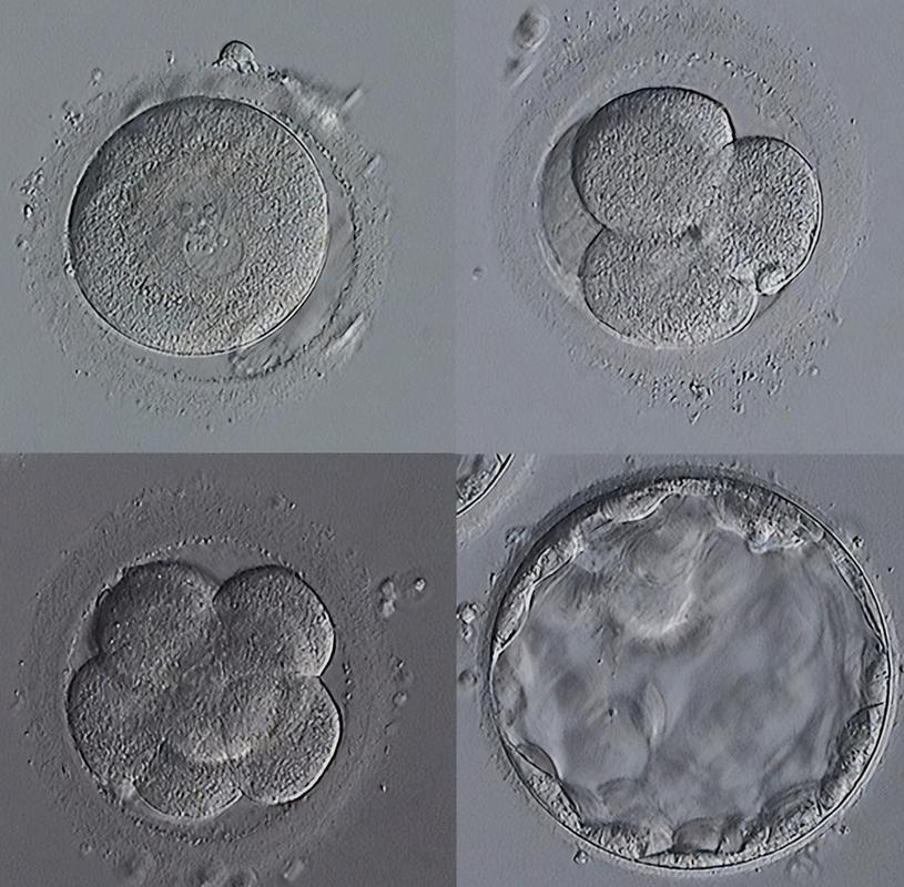 胚胎成功