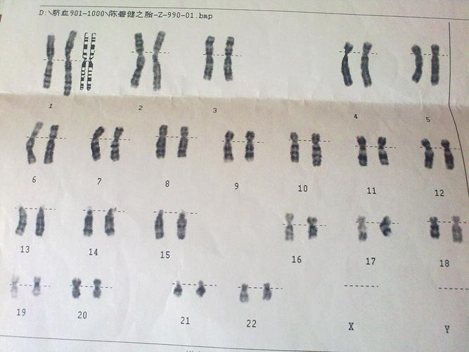 B 超检查次数