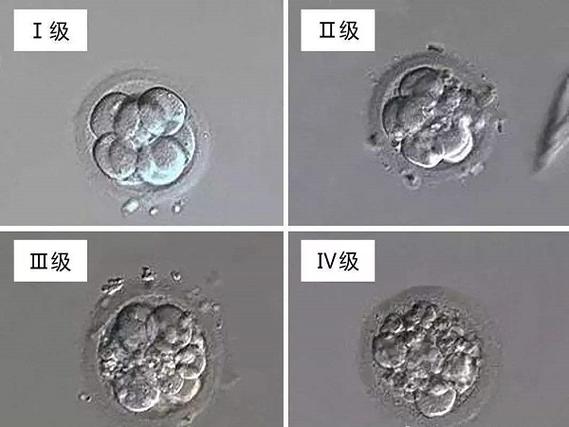 试管婴儿胚胎一级质量究竟好不好？详细分析与解读