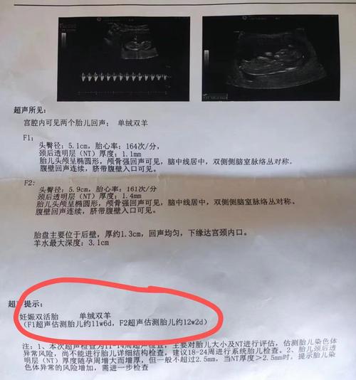 试管婴儿双胞胎能怀孕多少周才安全？