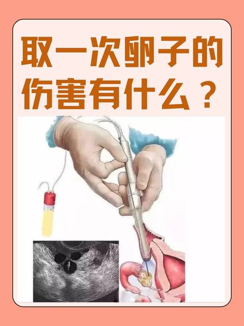 南昌供卵试管婴儿、医疗服务、生殖技术、卵子捐赠