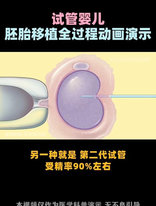 试管婴儿、第三代试管婴儿技术、3D 模拟、生殖医疗