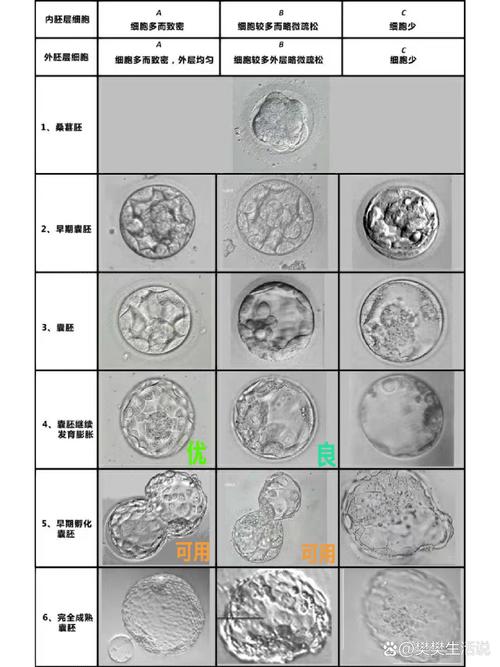 囊胚评级
