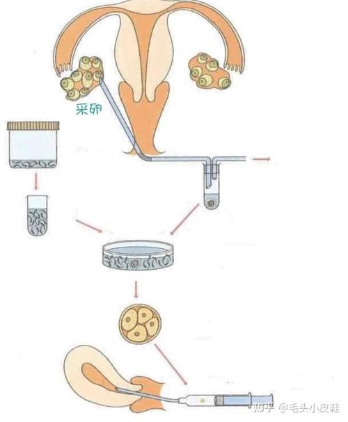 不能继续移植