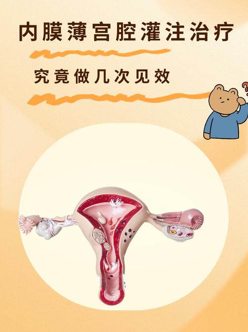 内膜薄患者是否必须选择试管婴儿治疗？