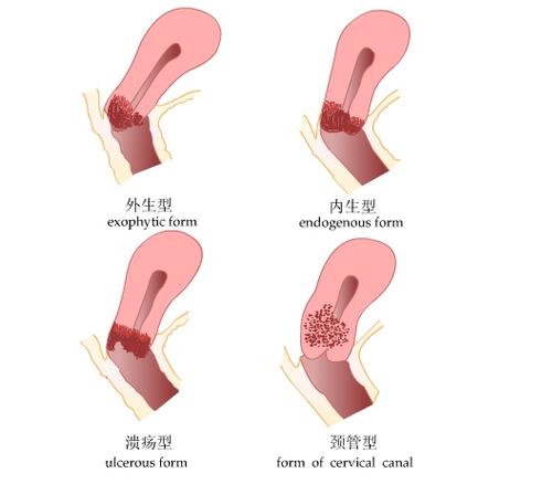 阴道少量出血