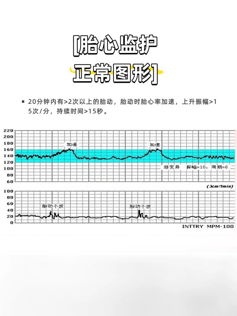 自然怀孕胎心率