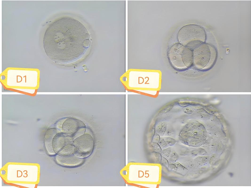 试管婴儿胚胎形态揭秘：为何它们呈圆形？