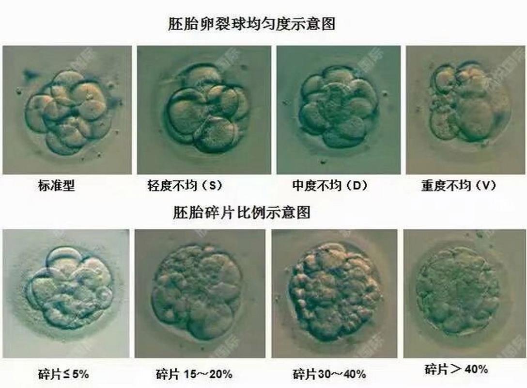 胚胎碎片率