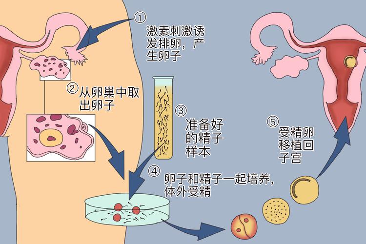 胚胎移植
描述: 本文详细介绍了试管婴儿技术中胚胎生成的全过程，包括前期准备、取卵取精、体外受精、胚胎培养、移植及妊娠检测等关键步骤，还列举了相关成功率数据，助您深入了解这一技术。