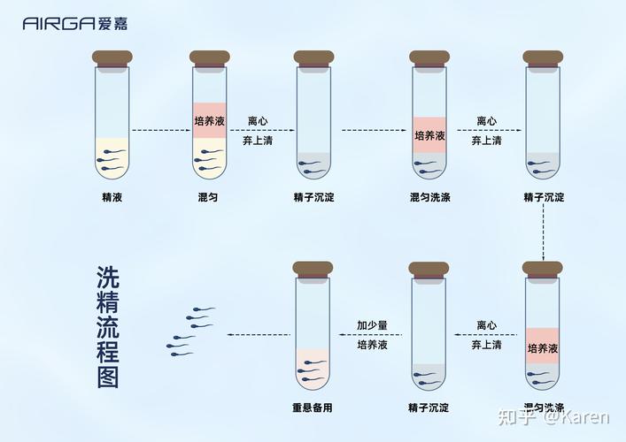  精子洗涤技术